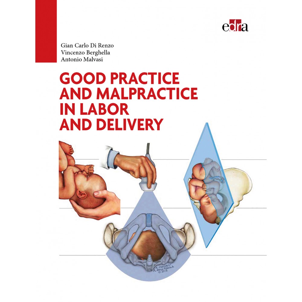 Good Practice and malpractice in labor and delivery - cover book - Medicine book - Gian Carlo Di Renzo - Vincenzo Berghella