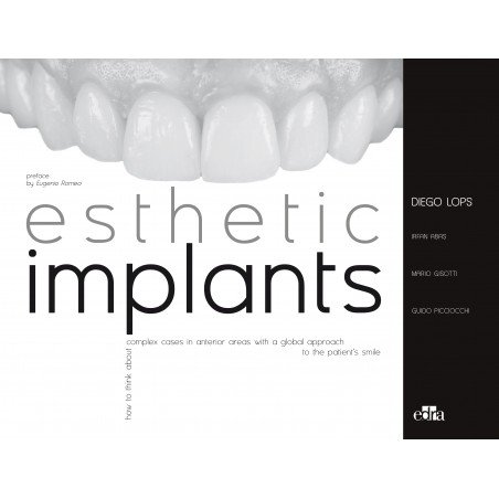 Esthetic Implants - book details - dentistry book - Guido Picciocchi -Mario Gisotti - Diego Lops
